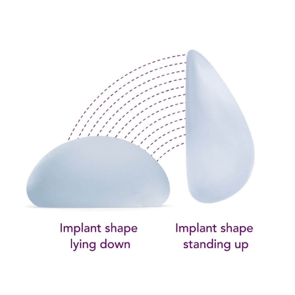Motiva implants