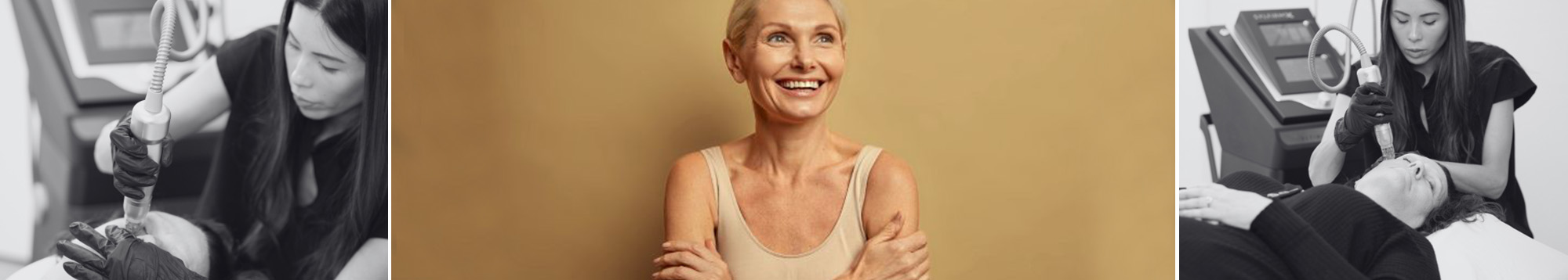 Viva skin resurfacing treatment in Wisconsin