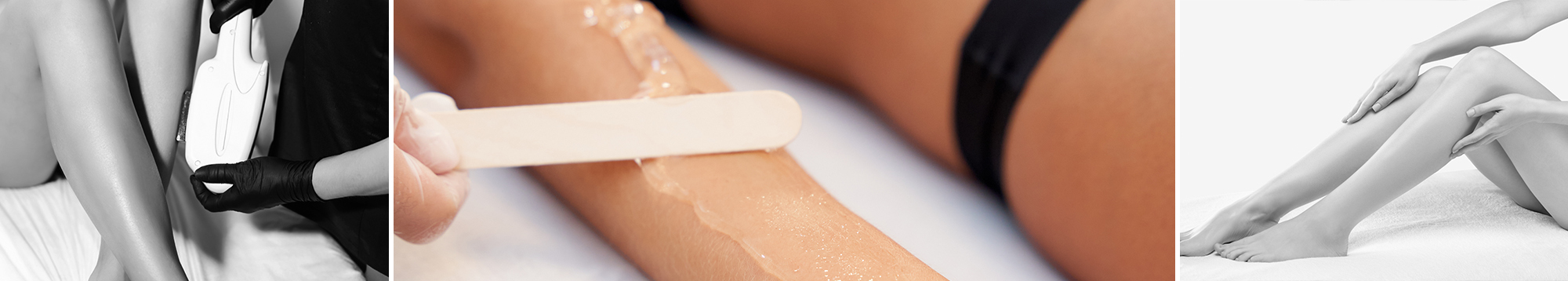 Laser hair removal treatments in Brookfield WI
