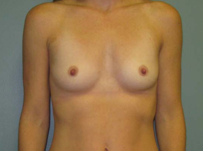 Before treatment: Reconstructive Surgeon Milwaukee