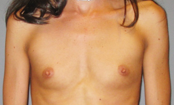 Before treatment: 