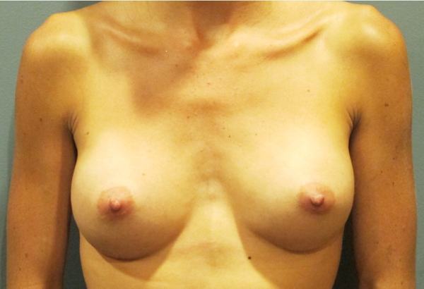 After treatment: 