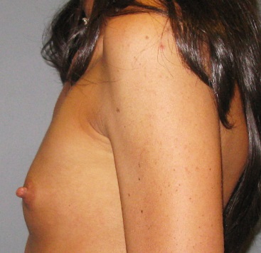Before treatment: 