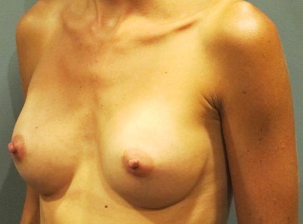 After treatment: 