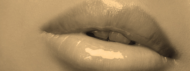 Botox and filler combination gallery