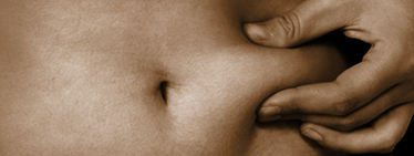Tummy tuck gallery