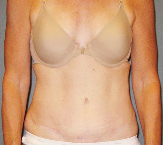 After treatment: 