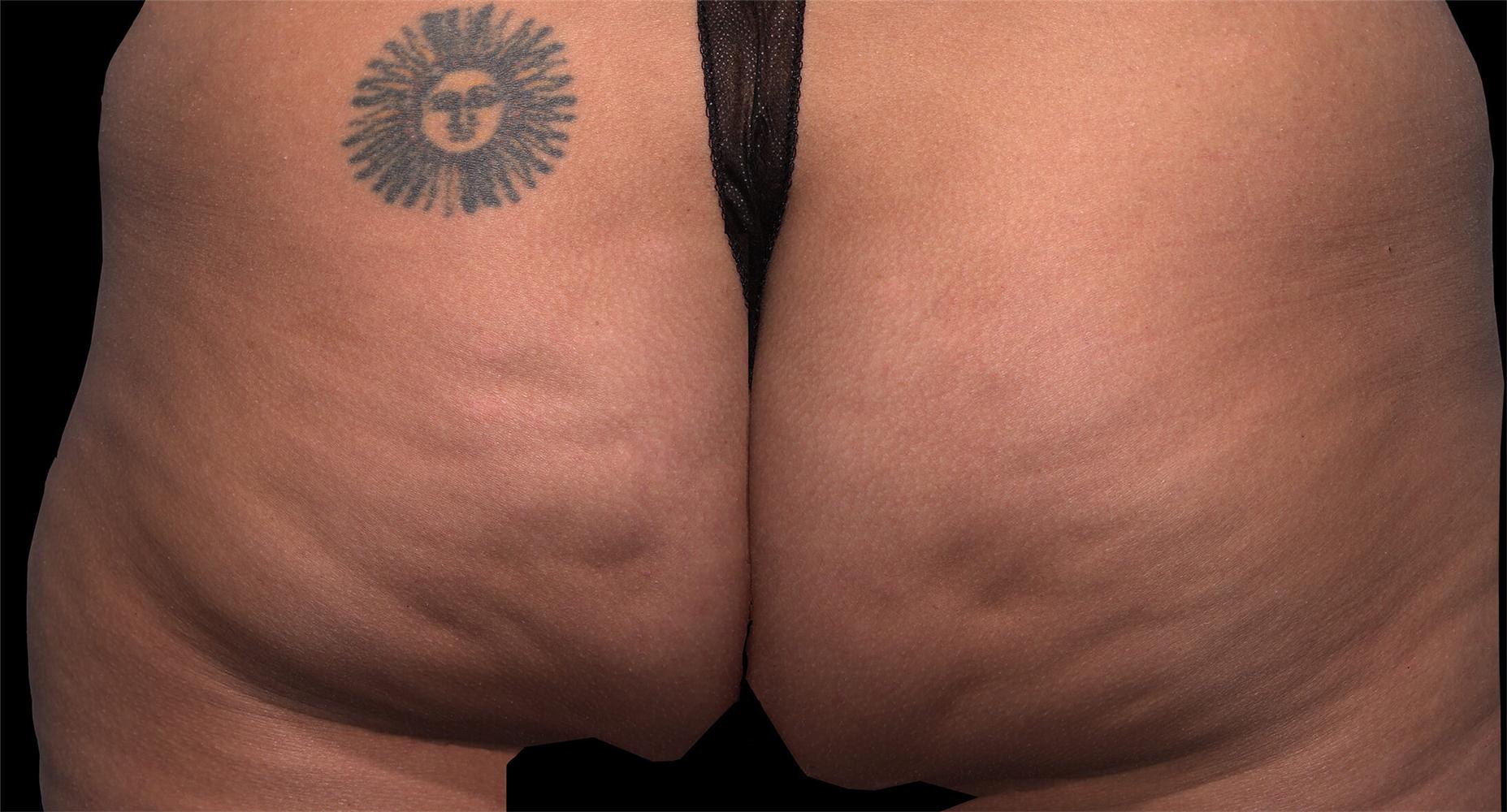 Before treatment: 