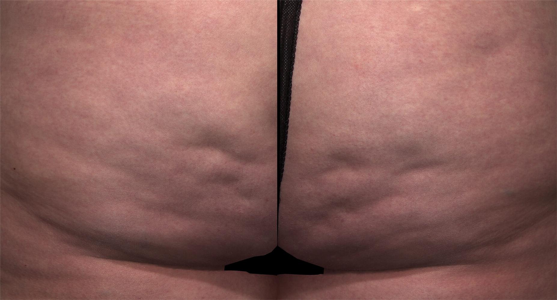 Before treatment: 
