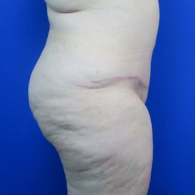 After treatment: 