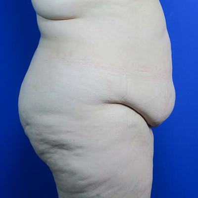Before treatment: 