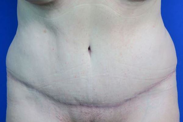 After treatment: 