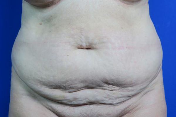 Before treatment: 