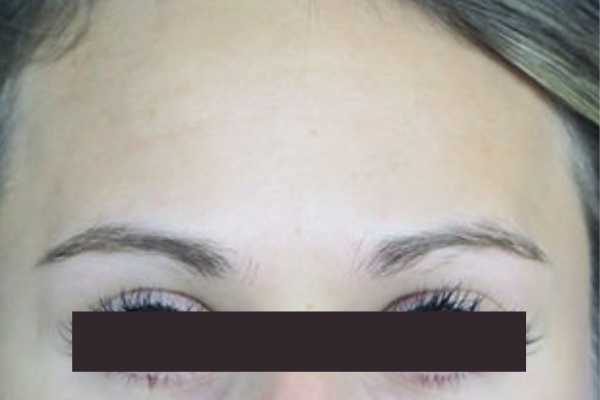 After treatment: 