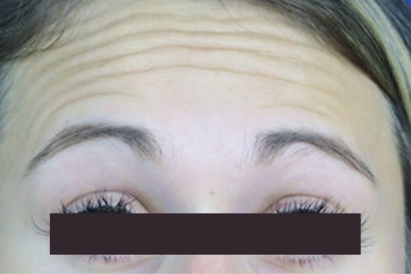 Before treatment: 