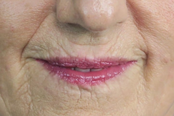 Before treatment: 