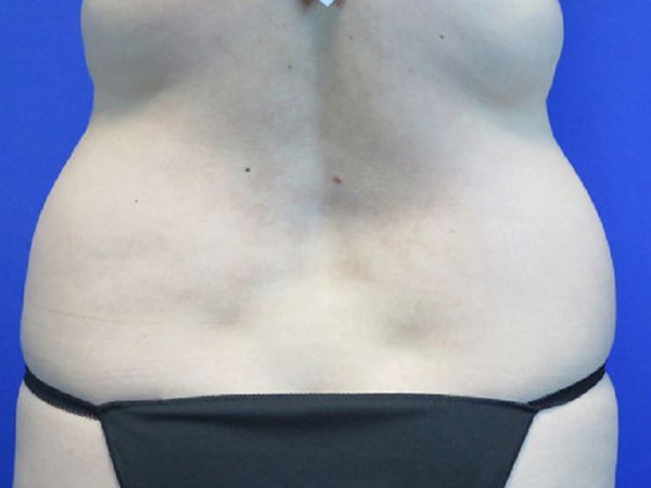 Before treatment: 