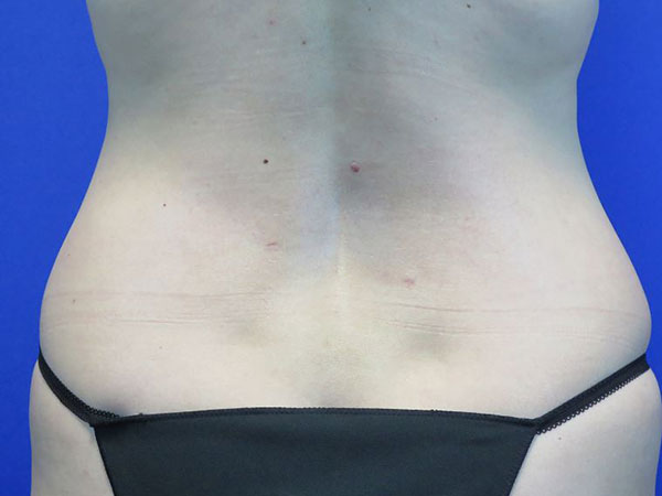 After treatment: 