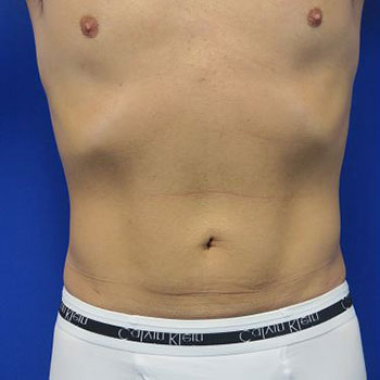 After treatment: 