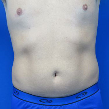 Before treatment: 