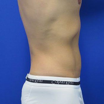 After treatment: 