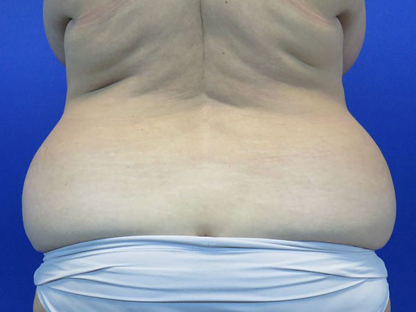Before treatment: 