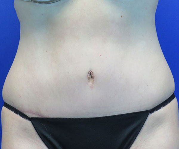 After treatment: 