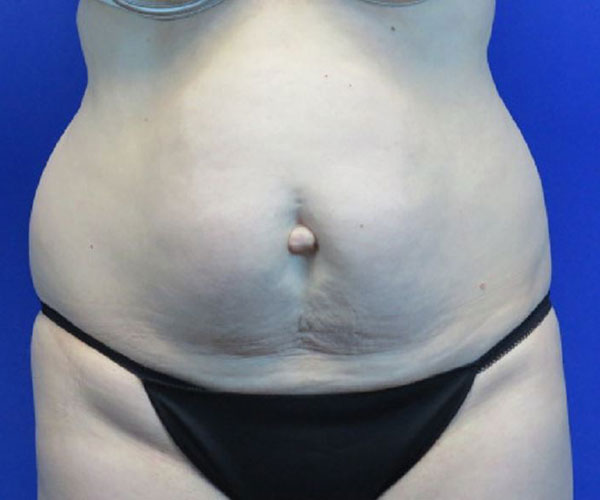Before treatment: 