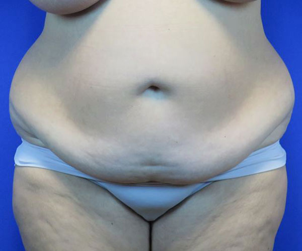 Before treatment: 