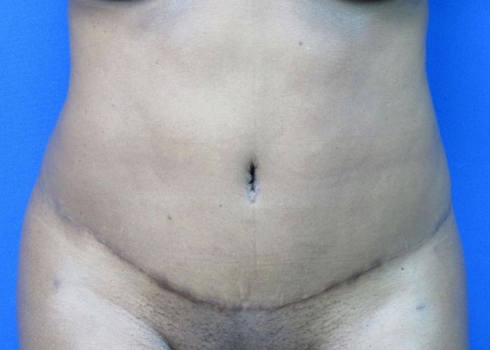 After treatment: 