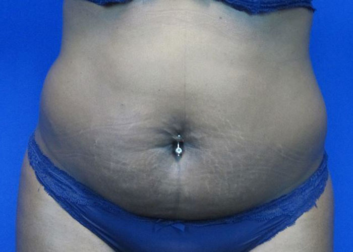 Before treatment: 