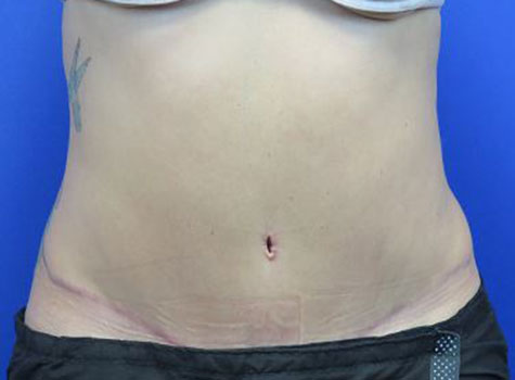 After treatment: 