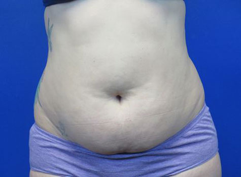 Before treatment: 