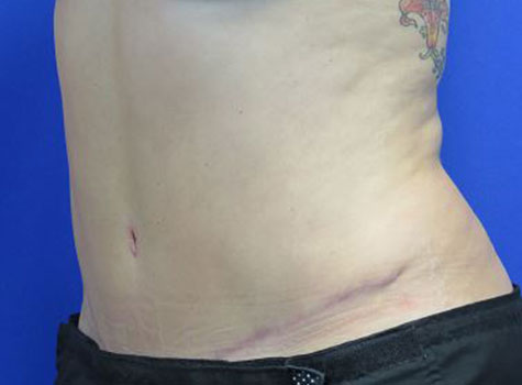 After treatment: 
