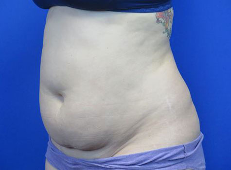Before treatment: 