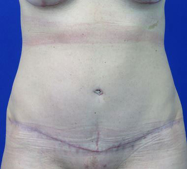 After treatment: 