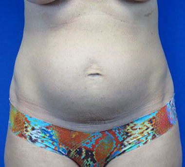 Before treatment: 