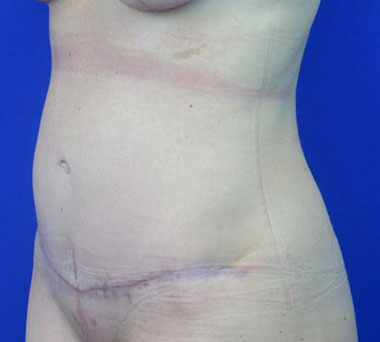 After treatment: 
