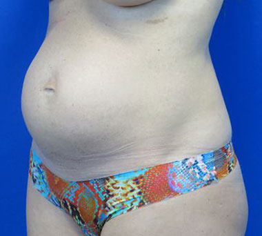 Before treatment: 