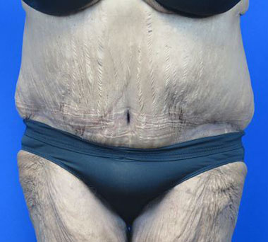 After treatment: 
