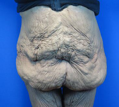 Before treatment: 