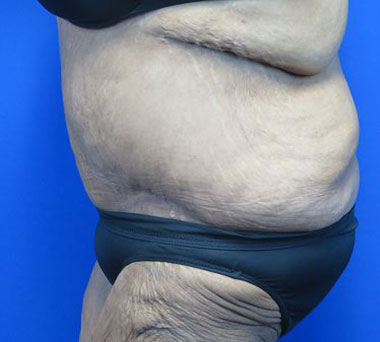 After treatment: 