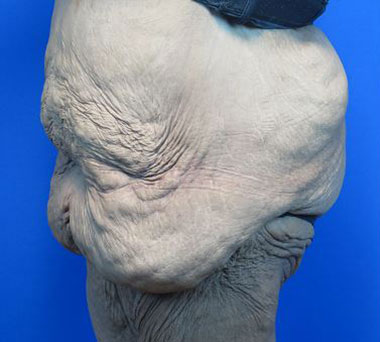 Before treatment: 