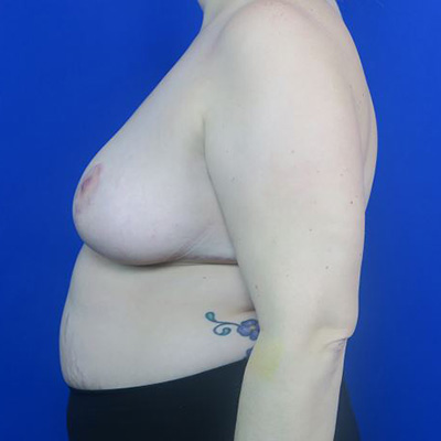 After treatment: 