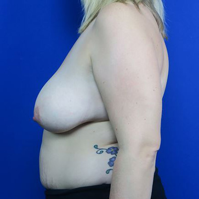 Before treatment: 