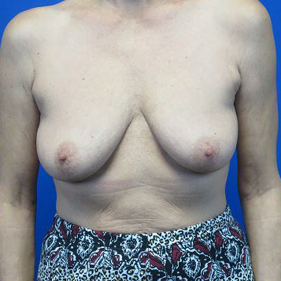 Before treatment: 